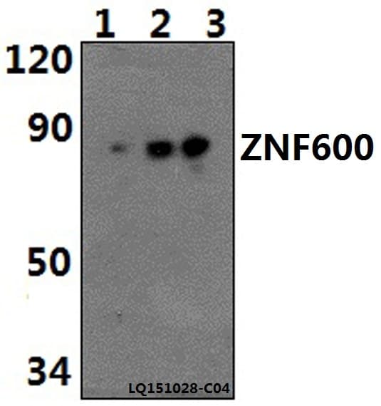 Polyclonal Rabbit anti-Human ZNF600 Antibody (WB)