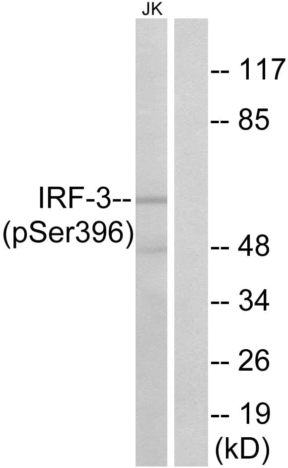 IRF3 Antibody (phospho-Ser396)