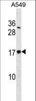 SSR4 Antibody (aa98-126)