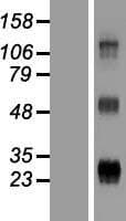 WFDC3 Protein (Over-Expression Lysate Myc-DDK (Flag))