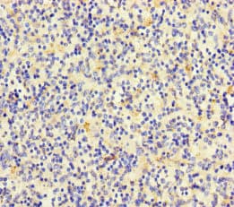 TLN2 / Talin 2 Antibody