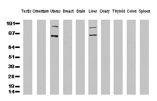 FOLH1 / PSMA Antibody (clone UMAB25, Carrier-free)