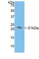 SFTPB / Surfactant Protein B Antibody (aa20-193)