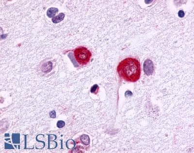PathPlus™ Polyclonal Rabbit anti-Human GPR17 Antibody (N-Terminus, IHC)