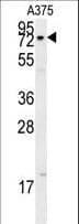 XRCC1 Antibody (aa407-435)