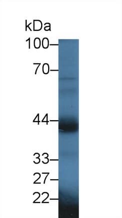 OXTR / Oxytocin Receptor Antibody (aa6-75)
