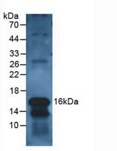 CLC Antibody (aa2-142, APC)