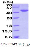 Human DHPS Protein (Recombinant His)