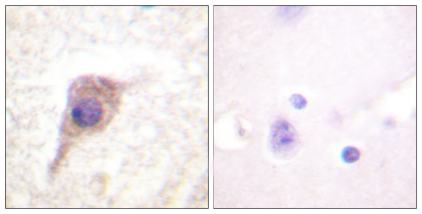 Polyclonal Rabbit anti-Human PRKCZ / PKC-Zeta Antibody (phospho-Thr560, IHC, WB)