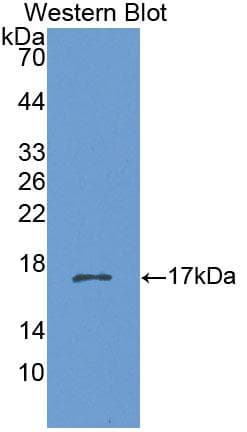 CHRNB3 Antibody (aa119-230, PE)