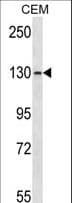 GRM1 / MGLUR1 Antibody (aa1095-1123)