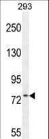 ZNF611 Antibody (aa1-30)