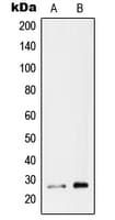 Polyclonal Rabbit anti-Human RAB26 Antibody (C-Terminus, WB)