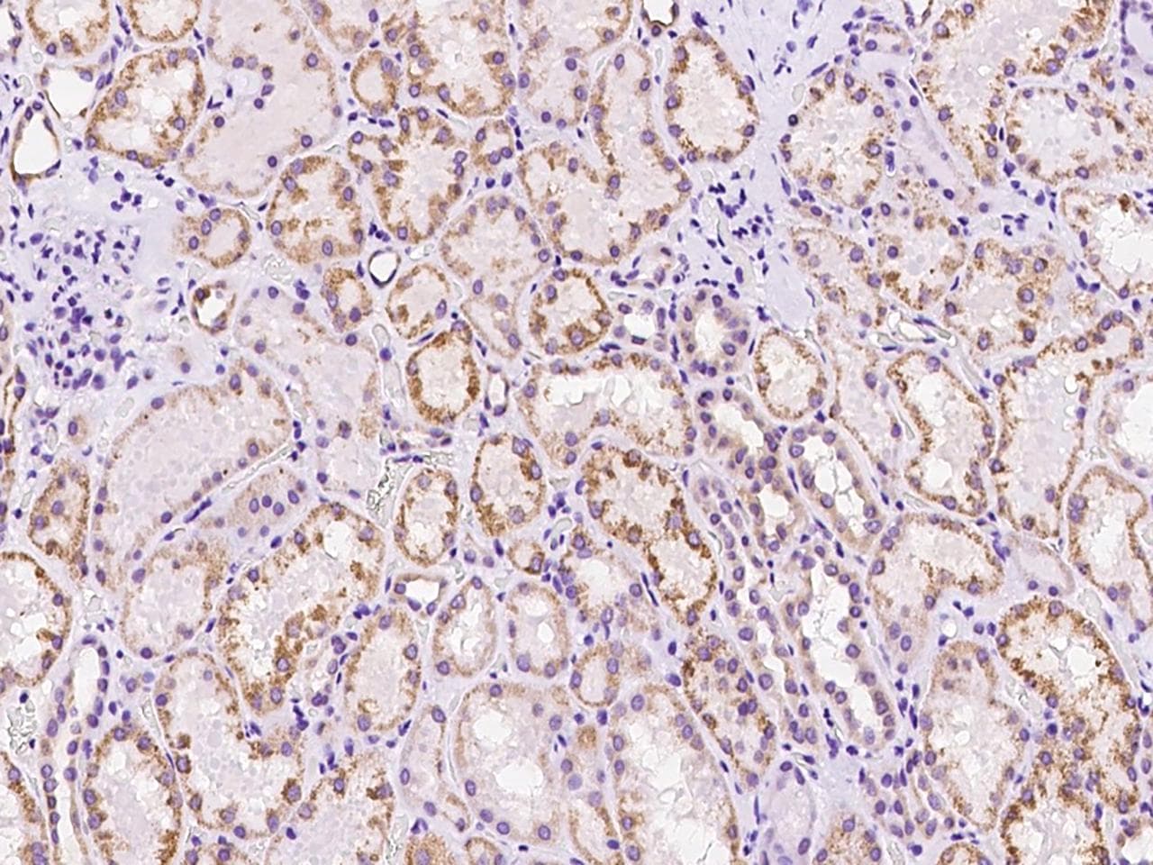 Polyclonal Rabbit anti-Human ALDH2 Antibody (IHC)