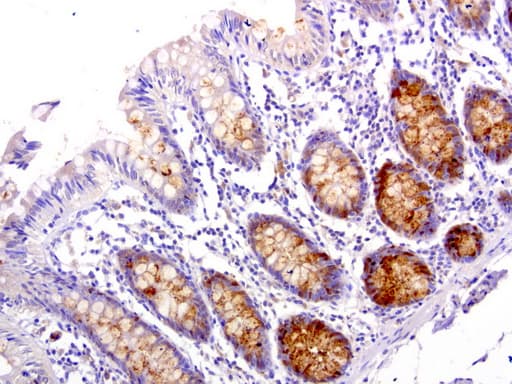 WFDC2 / HE4 Antibody (aa31-124, clone UMAB87)