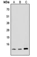 Polyclonal Rabbit anti-Human MED11 Antibody (Internal, WB)