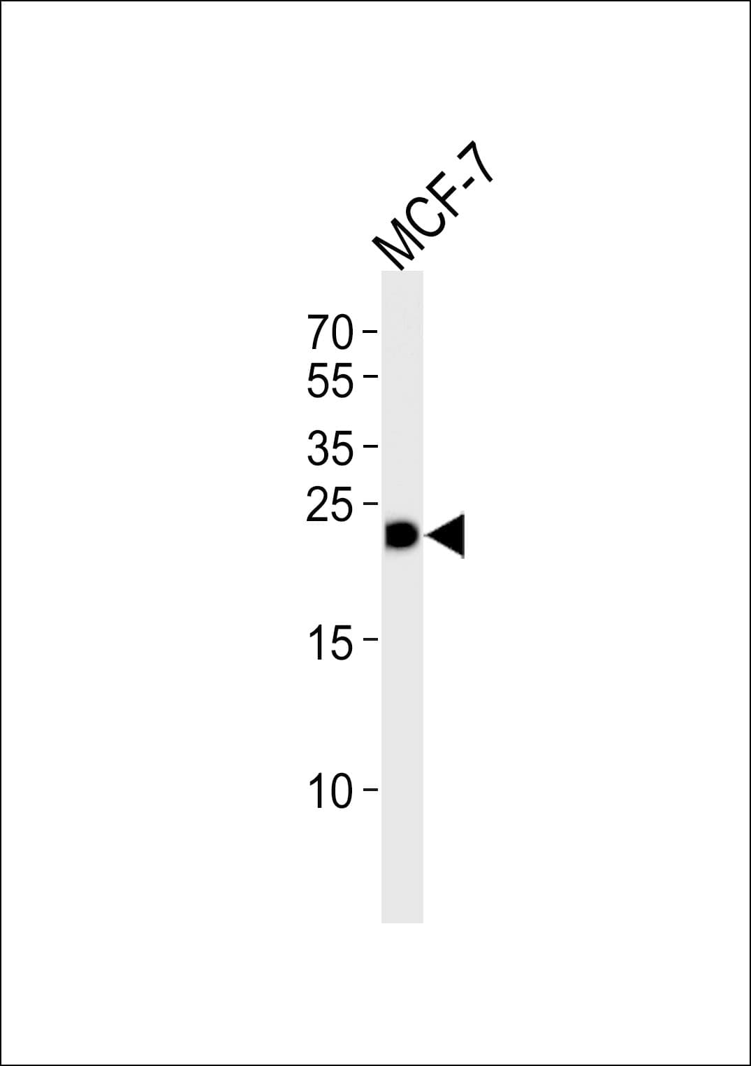 GSTM4-4 / GSTM4 Antibody (aa16-50)
