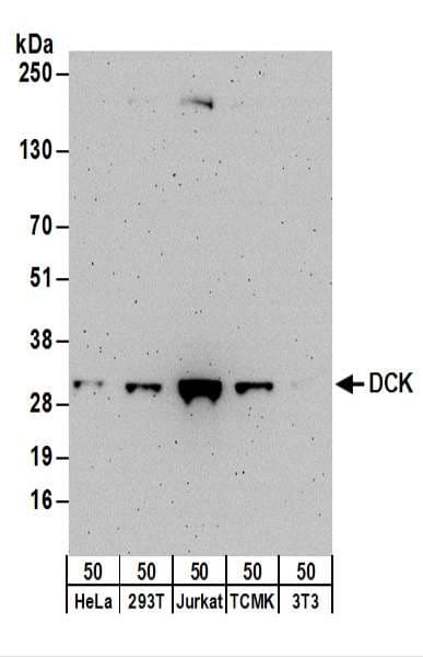 IHC-plus™ Polyclonal Rabbit anti-Human DCK / Deoxycytidine kinase Antibody (aa210-260, IHC, WB)