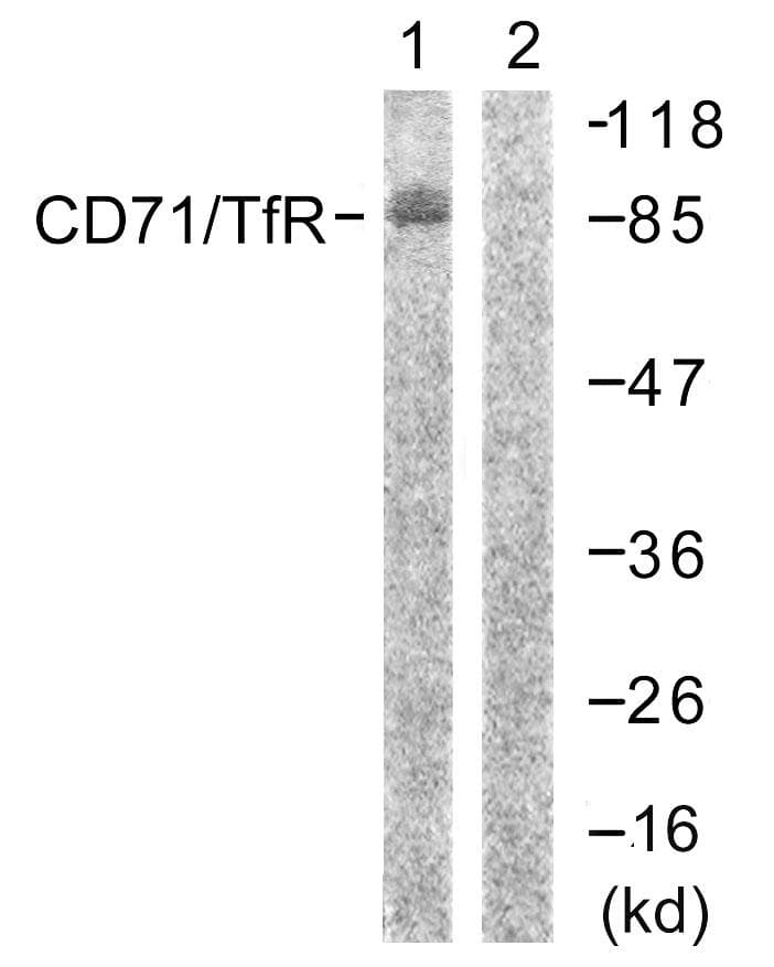 CD71 / Transferrin Receptor Antibody (p24)