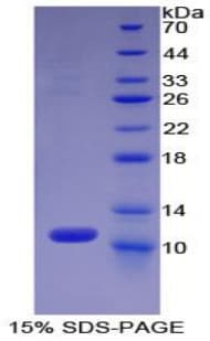 Human CCL13 / MCP4 Protein (Recombinant His)