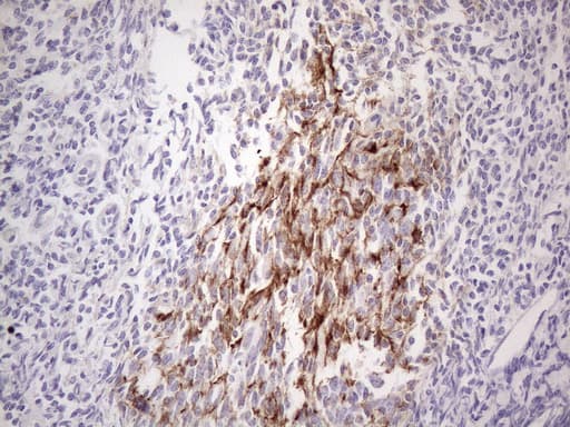 POTEG Antibody (clone OTI2G1)