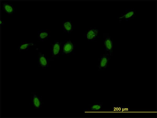 Monoclonal Mouse anti-Human CSE1L Antibody (clone 2C10, IF, WB)