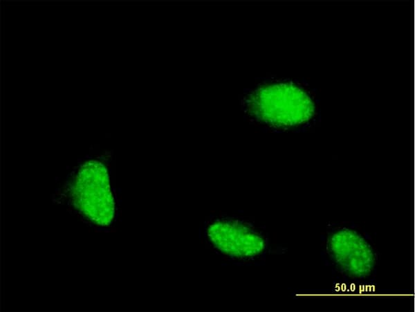 CSRP1 Antibody (clone 2A11)