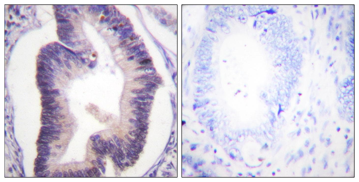 PFKFB2 Antibody (p483)