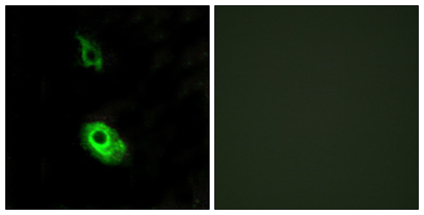 Polyclonal Rabbit anti-Human SIPR3 / EDG3 / S1P3 Antibody (aa1-50, IF, WB)