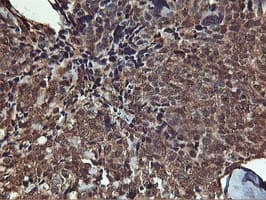AKT1 Antibody (clone OTI4E10)