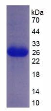 Human PTCH1 / Patched 1 Protein (Recombinant His-T7)