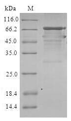 Human STEAP2 Protein (Recombinant 10His-SUMO, N-terminus)