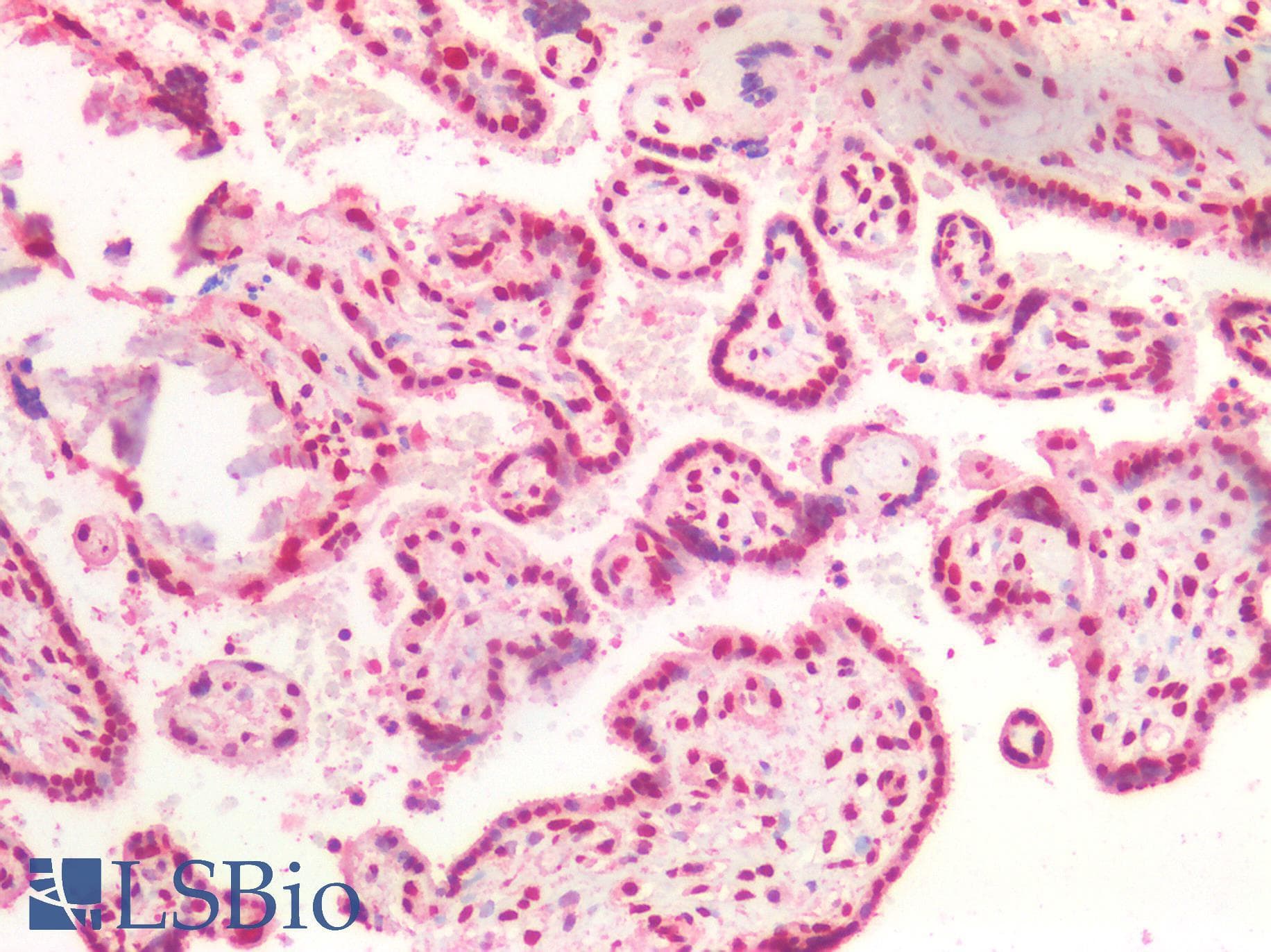IHC-plus™ CSTF2 / CstF-64 Antibody (aa309-320)