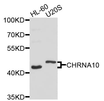 Polyclonal Rabbit anti-Human CHRNA10 Antibody (WB)