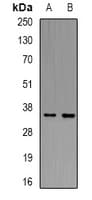 Polyclonal Rabbit anti-Human LAT Antibody (C-Terminus, WB)