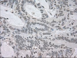 TSC501 / NAT8 Antibody (clone OTI6H3)