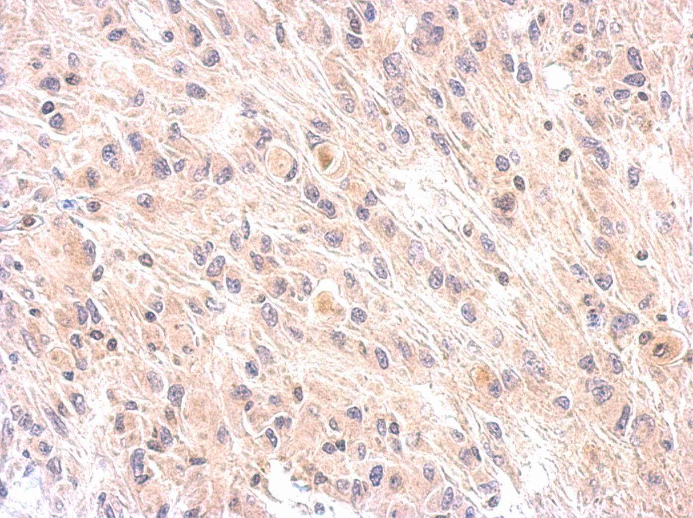 CFH / Complement Factor H Antibody (aa527-618)