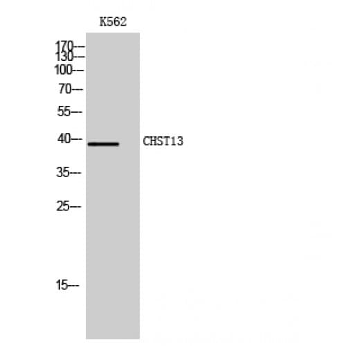Polyclonal Rabbit anti-Human CHST13 Antibody (180-260 aa, Internal, IHC, WB)