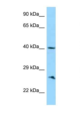 ABI1 / SSH3BP1 Antibody (C-Terminus)