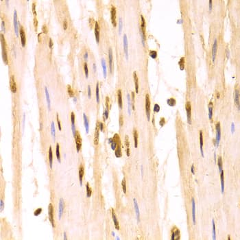 SFN / Stratifin / 14-3-3 Sigma Antibody