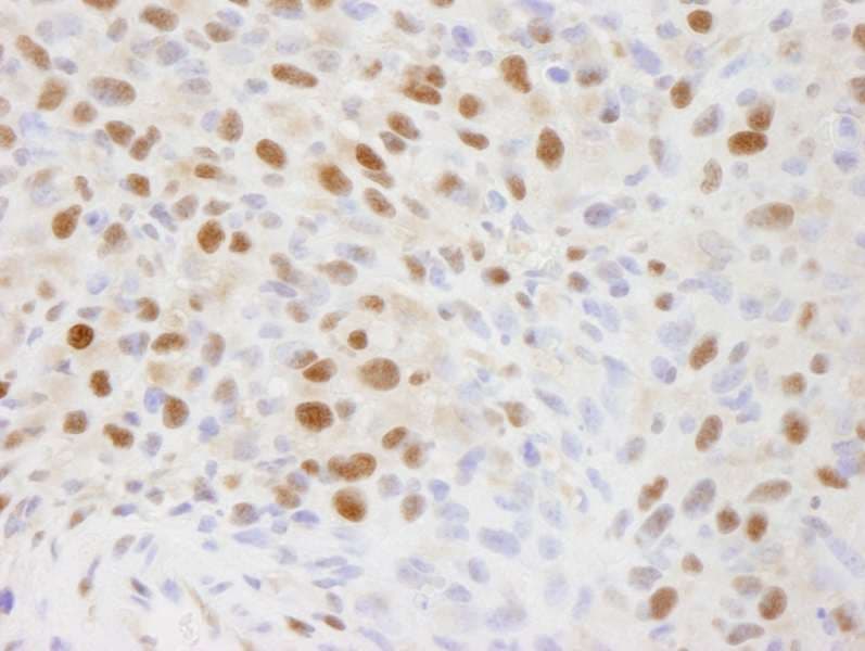 Polyclonal Rabbit anti-Human EFTUD2 Antibody (aa1-50, IHC)