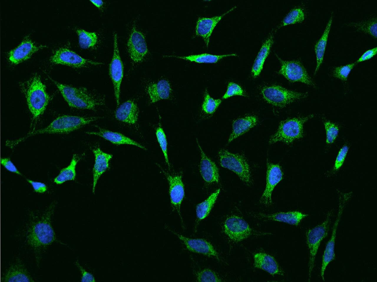 Recoverin Antibody