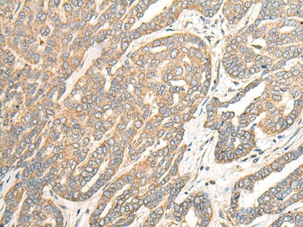 ABRI / ITM2B Antibody