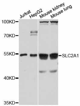 SLC2A1 / GLUT-1 Antibody