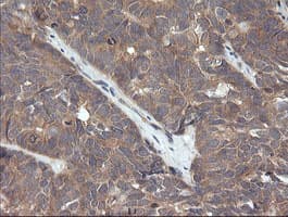 CTAG1B / NY-ESO-1 Antibody (clone OTI3H8, Carrier-free)