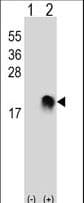 SUMO2 Antibody (N-Terminus)