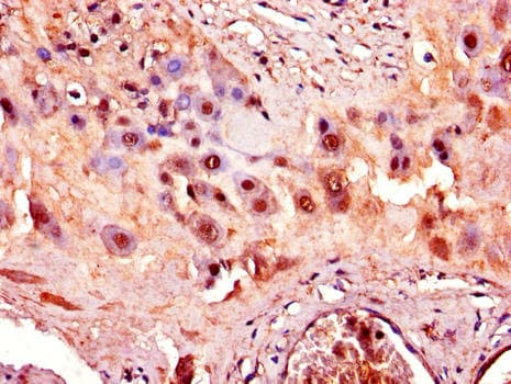 ADAM12 Antibody