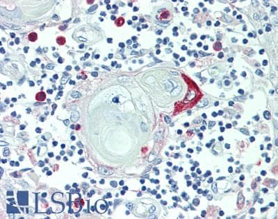 IHC-plus™ Polyclonal Rabbit anti-Human SRGN / Serglycin Antibody (IHC, IF, WB)