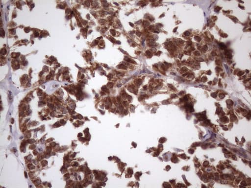 NDUFB11 Antibody (aa30-163, clone OTI9C5)