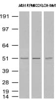 TP / Thymidine Phosphorylase Antibody (aa311-482, clone UMAB97, Carrier-free)
